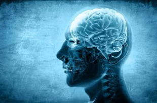 Brain Scan - Medical Malpractice